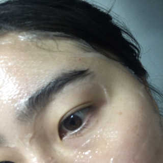 메디타임 멜라반 더마 토닝 씬젤 — 4점을 준 리뷰어가 2019년 6월 올린 사용 사진