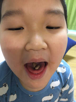 비타맘 키즈플러스업 성장기 어린이 멀티비타민미네랄 120정 — 5점을 준 리뷰어가 2020년 2월 올린 사용 사진