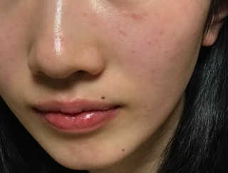 뷰디아니 01 토너, 03플루이드 세트 — 4점을 준 리뷰어가 2018년 4월 올린 사용 사진