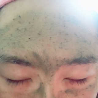 글랜무어 디톡 제올라이트 클리어링 버블 팩 — 3.5점을 준 리뷰어가 2018년 5월 올린 사용 사진