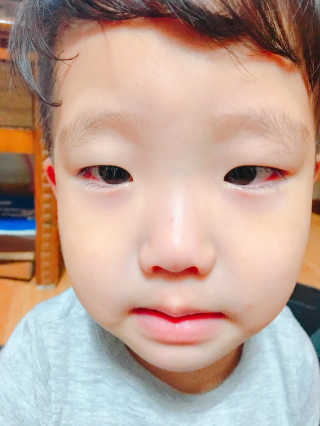 빅그린 스킨베리어 베이비 시어테라피 크림 — 4.5점을 준 리뷰어가 2016년 10월 올린 사용 사진