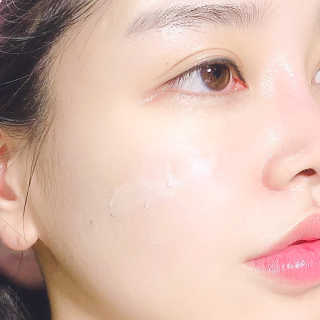 스케덤 클루덤 메디 에프터 크림 — 5점을 준 리뷰어가 2019년 2월 올린 사용 사진