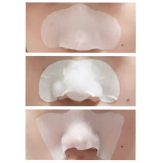 오리지널 미팩토리 3단 돼지코팩 5매입 X 2 — 4.17점을 준 리뷰어가 2018년 7월 올린 사용 사진