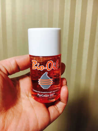 Bio-oil(바이오오일) 바이오오일(Bio-oil) — 5점을 준 리뷰어가 2017년 1월 올린 사용 사진