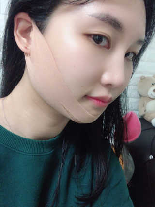 아이디플라코스메틱 아이디 페이스핏 마이너스 밴드 — 5점을 준 리뷰어가 2020년 3월 올린 사용 사진