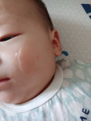 뷰티여우_아토클리닉 [아토클리닉] 아기들이 쓰는 보습, 진정 수딩젤 2개 — 5점을 준 리뷰어가 2019년 7월 올린 사용 사진