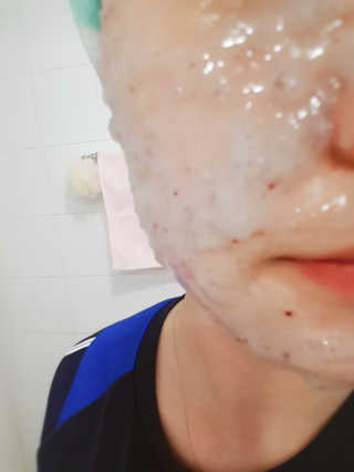 23years old 아쿠아밥 모델링 마스크 — 5점을 준 리뷰어가 2018년 4월 올린 사용 사진