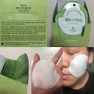 [후르디아] 청포도 매끈약산성 필링 패드_50매 세트 — 5점을 준 리뷰어가 2019년 9월 올린 사용 사진