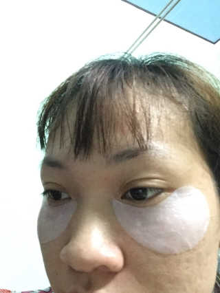 엘리자베카 덩키피기 덩키밀키 EGF 클링아이패치 — 5점을 준 리뷰어가 2019년 5월 올린 사용 사진