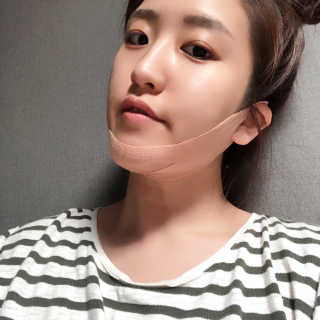 아이디플라코스메틱 아이디 페이스핏 마이너스 밴드 — 2점을 준 리뷰어가 2019년 9월 올린 사용 사진