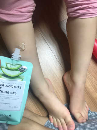 셀레뷰 슈퍼 모이스처 수딩젤 — 5점을 준 리뷰어가 2018년 3월 올린 사용 사진