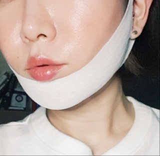 스케덤 클루덤 리프팅 패치 — 4.5점을 준 리뷰어가 2019년 3월 올린 사용 사진