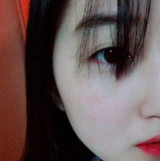 2018 아이소이 잡티세럼 리미티드 컬렉션 — 5점을 준 리뷰어가 2018년 2월 올린 사용 사진