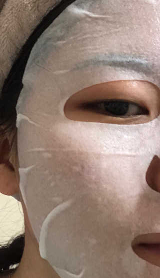 유산균하우스 [프로바이오닉]스킨프로바이오틱스 마스크 10매입 — 5점을 준 리뷰어가 2019년 3월 올린 사용 사진