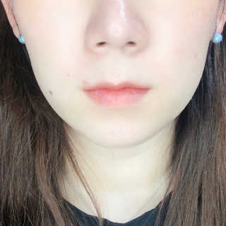 아이디플라코스메틱 아이디 페이스핏 마이너스 밴드 — 3점을 준 리뷰어가 2020년 4월 올린 사용 사진