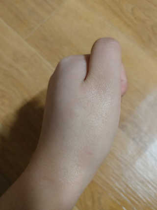 나이팅게일 티타민 크림 리뉴얼 — 4.17점을 준 리뷰어가 2018년 3월 올린 사용 사진
