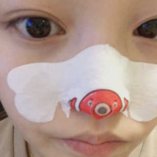 나이팅게일 TAKO PACK NOSE [문어코팩] — 3점을 준 리뷰어가 2017년 5월 올린 사용 사진