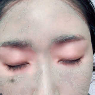 플러스셀라 시카골드 클렌징바 화산재팩 세트 — 5점을 준 리뷰어가 2020년 3월 올린 사용 사진