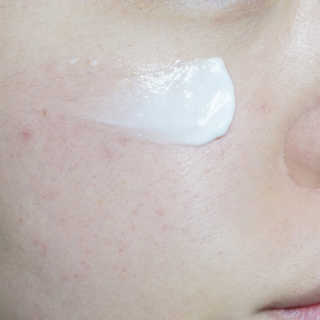 세바메드 우레아 수분폭탄크림 50ml — 4점을 준 리뷰어가 2019년 12월 올린 사용 사진