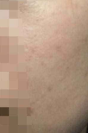 포렌코즈 인헤일 에어 컬러 베이스 — 2점을 준 리뷰어가 2017년 9월 올린 사용 사진