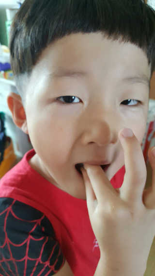 메디미 인탁트 테디베어 포도당 딸기맛 — 3.67점을 준 리뷰어가 2017년 6월 올린 사용 사진