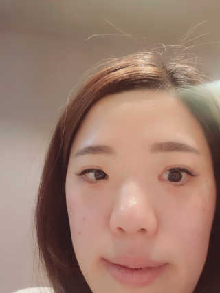 Viewty Skin and Lash [ViewtySkin＆Lash] 종아리 림프순환 부종관리 — 5점을 준 리뷰어가 2019년 4월 올린 사용 사진