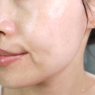센텐스 블랙사피르 프로폴리스 팅크처 페이셜 앰플 — 5점을 준 리뷰어가 2019년 10월 올린 사용 사진