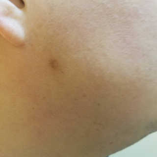 iamskinobsessed님이 올린 리뷰 사진 3