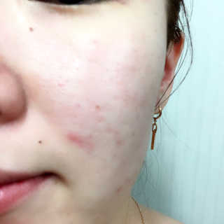 셀라피 에이리페어플러스크림 — 4.67점을 준 리뷰어가 2018년 4월 올린 사용 사진