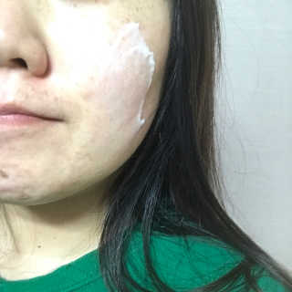 나이팅게일 티타민 크림 리뉴얼 — 4점을 준 리뷰어가 2018년 4월 올린 사용 사진