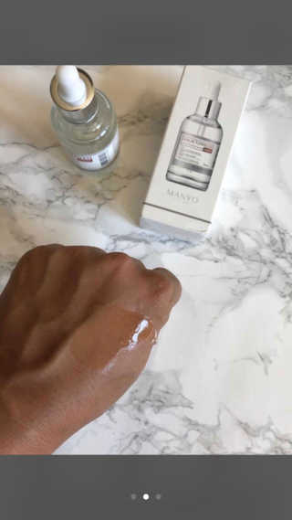 [마녀 공장] 발가락 토미 니아신 에센스 50ml — 5점을 준 리뷰어가 2018년 10월 올린 사용 사진