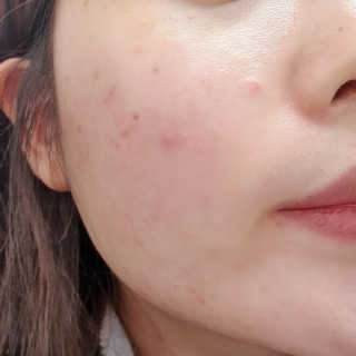 CoverMed 커버메드 퍼펙트 모이스처 쿠션 — 4.5점을 준 리뷰어가 2020년 2월 올린 사용 사진