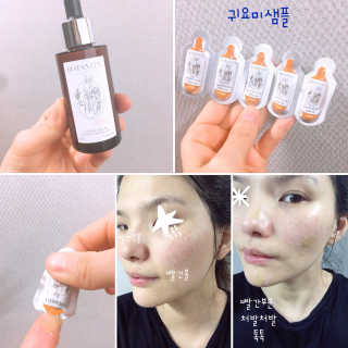 보타니티 [홍]조[진]정[결]케어 플라본 세럼 — 5점을 준 리뷰어가 2018년 5월 올린 사용 사진