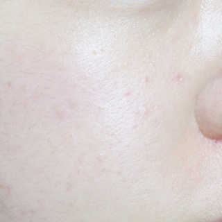 세바메드 우레아 수분폭탄크림 50ml — 4점을 준 리뷰어가 2019년 12월 올린 사용 사진