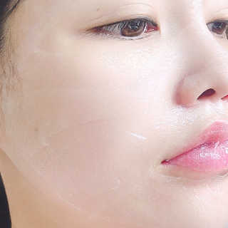 메디타임 멜라반 더마 토닝 씬젤 — 4점을 준 리뷰어가 2019년 5월 올린 사용 사진