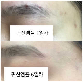 시카고 시카 더블 이펙트 앰플 30ml 기획세트 — 5점을 준 리뷰어가 2018년 8월 올린 사용 사진