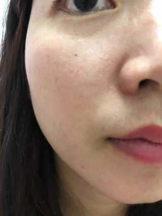 [더메디닥터] 글리셜 미셀라 클렌징 워터 — 4점을 준 리뷰어가 2019년 4월 올린 사용 사진