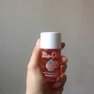 Bio-oil(바이오오일) 바이오오일(Bio-oil) — 4점을 준 리뷰어가 2017년 1월 올린 사용 사진