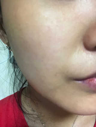 온가족 수분뿜뿜 노랑뚜껑 재주꾼 와우374 스네일토너 — 4점을 준 리뷰어가 2019년 9월 올린 사용 사진