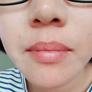 [후르디아] 블루베리 과즙 듬뿍 꿀과즙립밤 3개 세트 — 5점을 준 리뷰어가 2019년 11월 올린 사용 사진