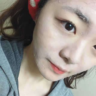 셀퓨전씨 트리악 포어 딜리트 버블 팩 — 4.5점을 준 리뷰어가 2018년 4월 올린 사용 사진