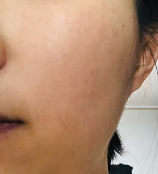 라임코스메틱 V 콜라겐 앰플 쿠션 — 4점을 준 리뷰어가 2020년 1월 올린 사용 사진
