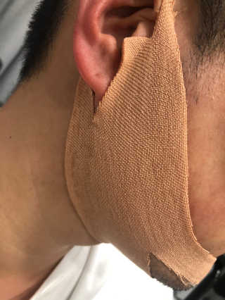 아이디플라코스메틱 아이디 페이스핏 마이너스 밴드 — 1점을 준 리뷰어가 2019년 11월 올린 사용 사진