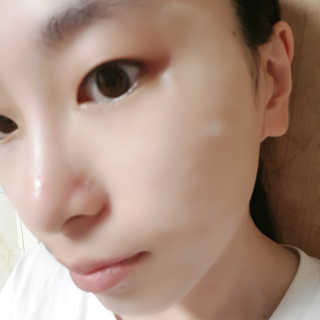 [더마펌] 인텐시브케어 아이존 패치 — 5점을 준 리뷰어가 2019년 10월 올린 사용 사진