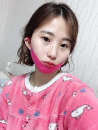 스케덤 펩타이드 리프팅밴드 — 3.5점을 준 리뷰어가 2019년 3월 올린 사용 사진