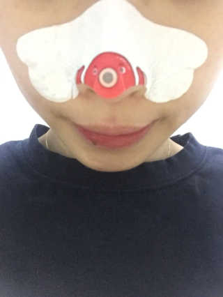 나이팅게일 TAKO PACK NOSE [문어코팩] — 2.5점을 준 리뷰어가 2017년 4월 올린 사용 사진