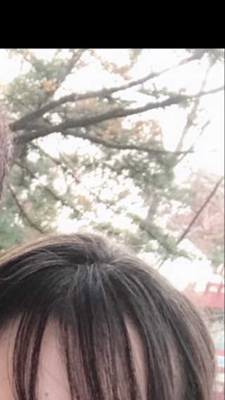 [크리산]  모근.모발강화 악티프 토닉 — 5점을 준 리뷰어가 2019년 12월 올린 사용 사진