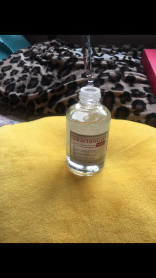 [마녀 공장] 발가락 토미 니아신 에센스 50ml — 5점을 준 리뷰어가 2019년 2월 올린 사용 사진