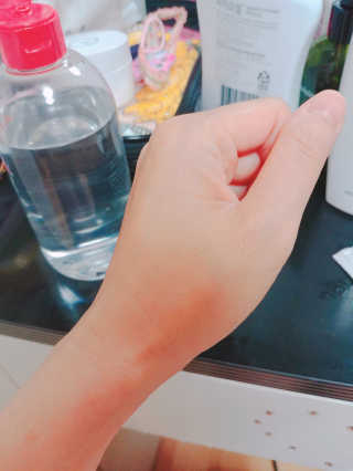 솔테라피 안나 트러블 토너 300ml — 5점을 준 리뷰어가 2019년 5월 올린 사용 사진