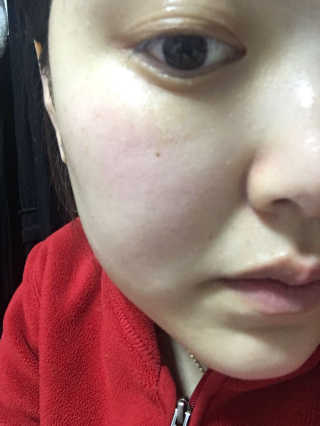 엘리자베카 펩타이드 쓰리디 픽스 슈팅 버블 페이셜 에센스 — 4.17점을 준 리뷰어가 2018년 1월 올린 사용 사진